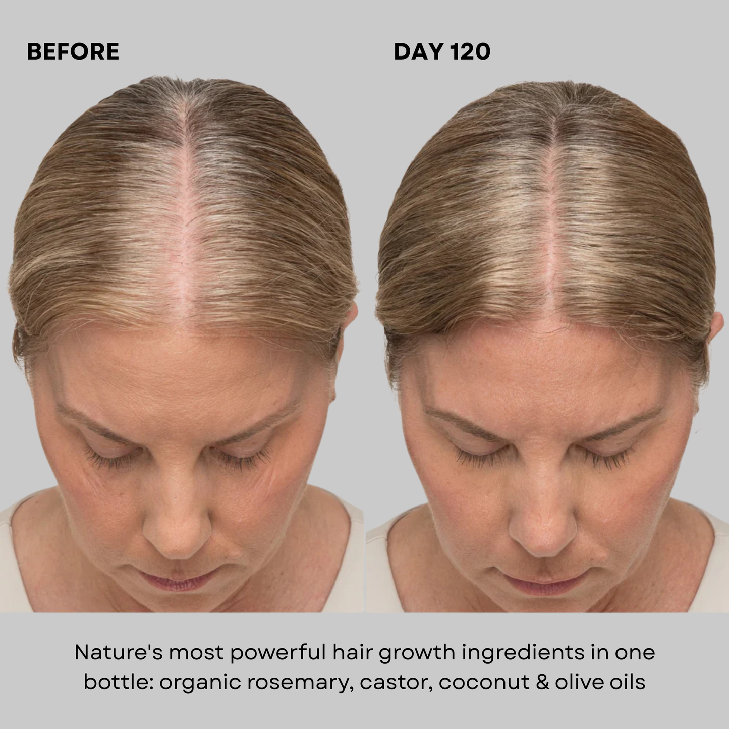 Vedura™ Herbal Growth Oil