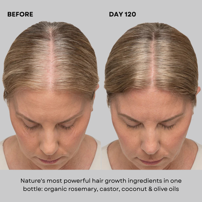 Vedura™ Herbal Growth Oil